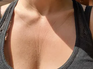 How I Finally Got Rid of Deep Lines & Wrinkles on My Chest & Neck