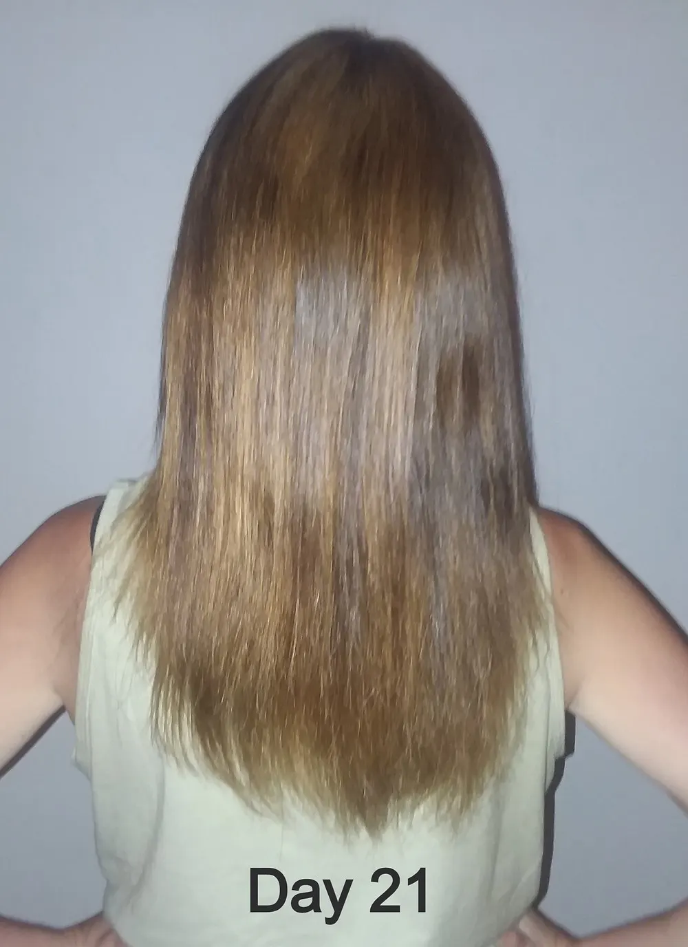 Hair length at 21 days