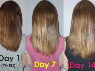 How to Grow Hair Longer, Thicker & Faster: Super Easy & Cheap!  Works Fast to Grow Hair Naturally