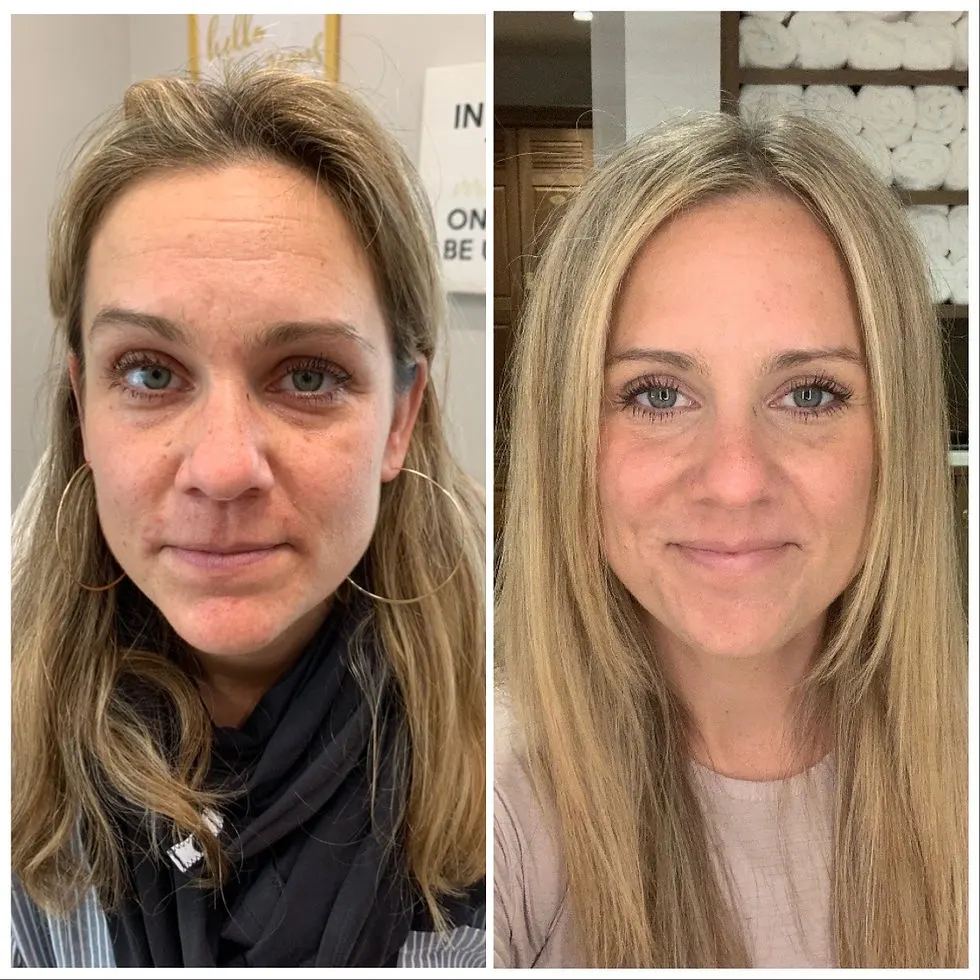 Before and After 