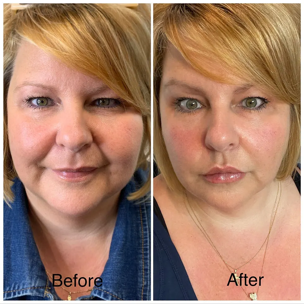 Before and After 