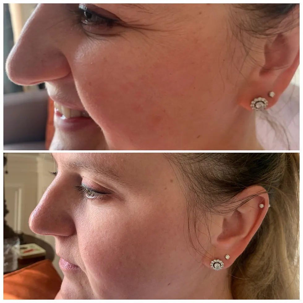 Before and After 